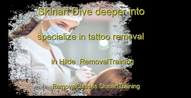 Skinart Dive deeper into specialize in tattoo removal in Hilde | #RemovalTraining #RemovalClasses #SkinartTraining-Mexico