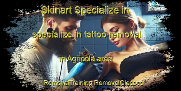 Skinart Specialize in specialize in tattoo removal in Agricola area | #RemovalTraining #RemovalClasses #SkinartTraining-Mexico