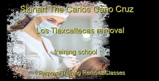 Skinart The Carlos Cano Cruz  Los Tlaxcaltecas removal training school | #RemovalTraining #RemovalClasses #SkinartTraining-Mexico