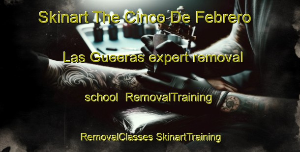 Skinart The Cinco De Febrero  Las Gueeras expert removal school | #RemovalTraining #RemovalClasses #SkinartTraining-Mexico