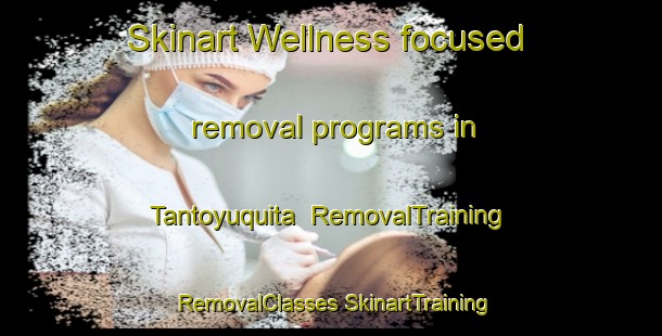 Skinart Wellness-focused removal programs in Tantoyuquita | #RemovalTraining #RemovalClasses #SkinartTraining-Mexico